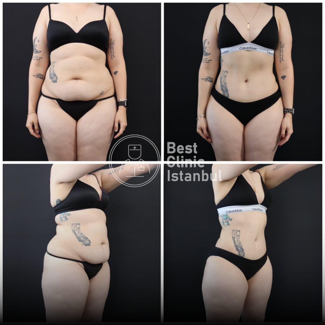 WhatsApp-Image-2025-01-16-at-22.53.28_595675ba