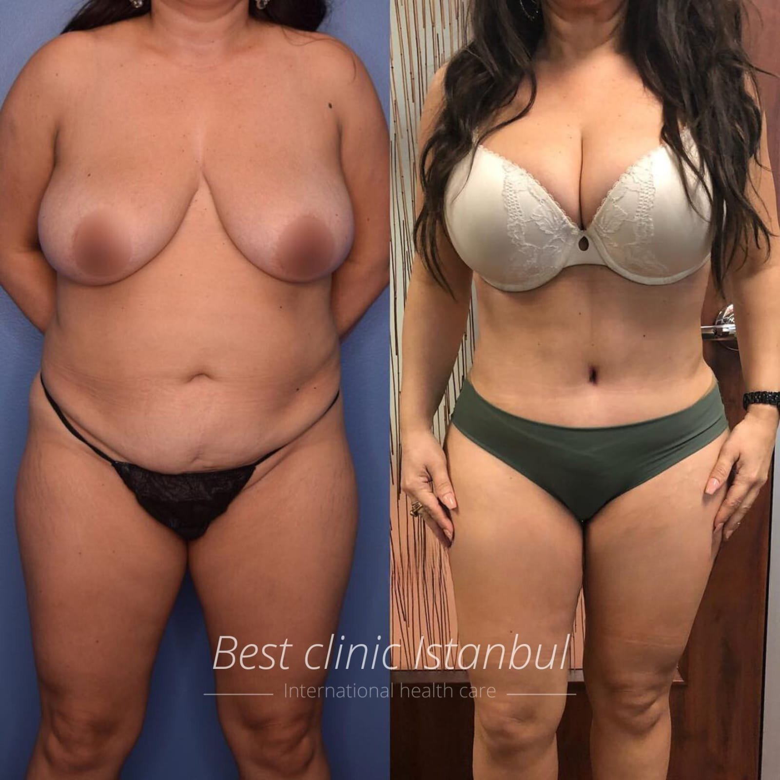 WhatsApp-Image-2025-01-16-at-22.53.32_413fc5f5