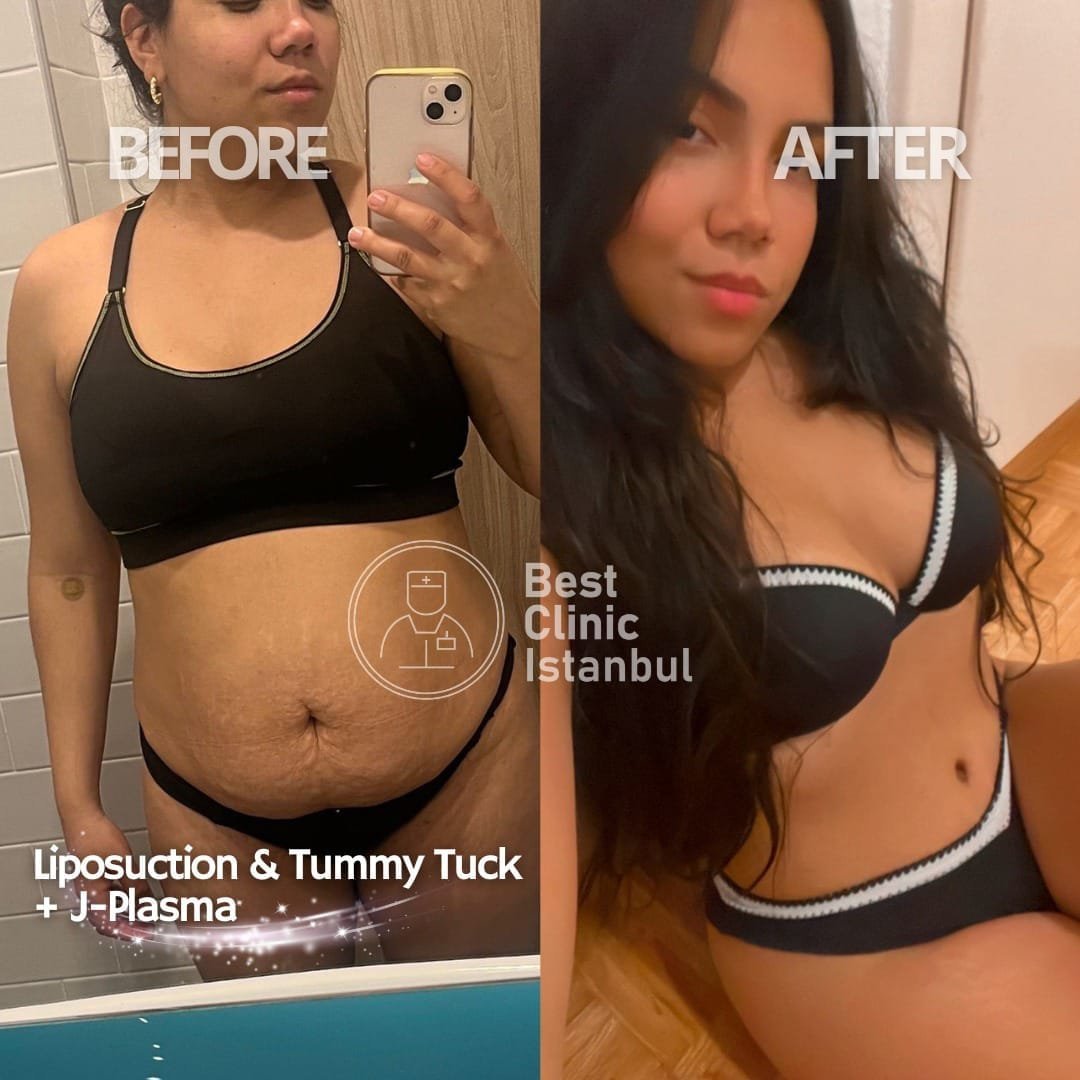 WhatsApp-Image-2025-01-16-at-22.53.36_dcff0135