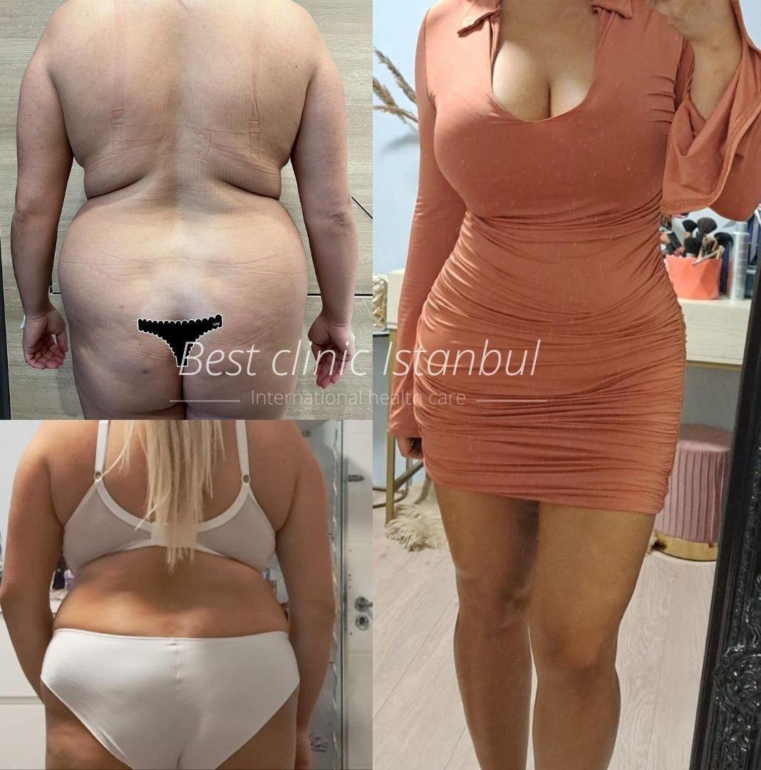 WhatsApp-Image-2025-01-16-at-22.53.38_9221629b