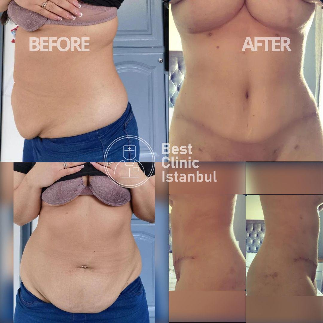 WhatsApp-Image-2025-01-16-at-22.54.14_c593c50f