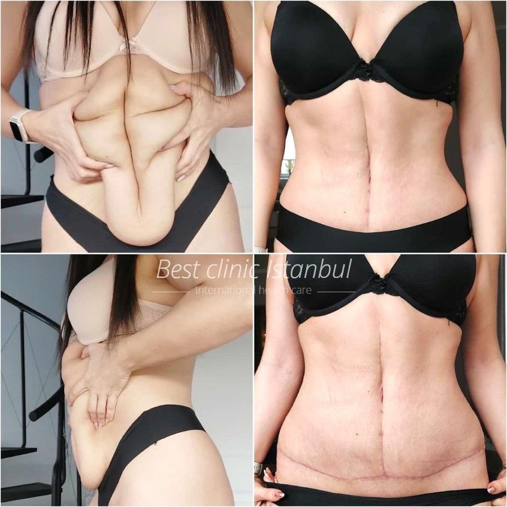 WhatsApp-Image-2025-01-16-at-22.54.28_0fcb9246