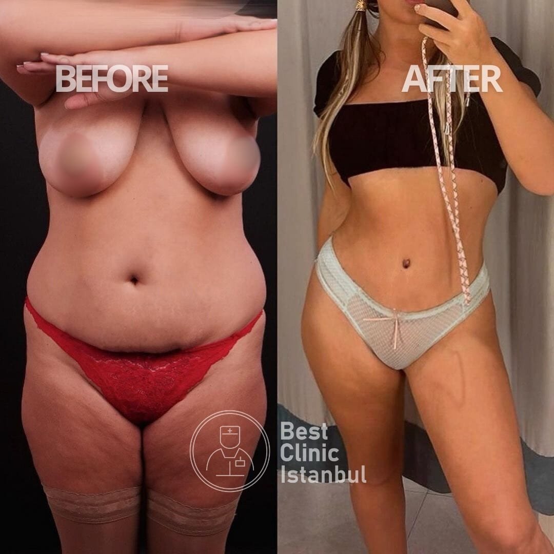 WhatsApp-Image-2025-01-16-at-22.54.39_219c6739