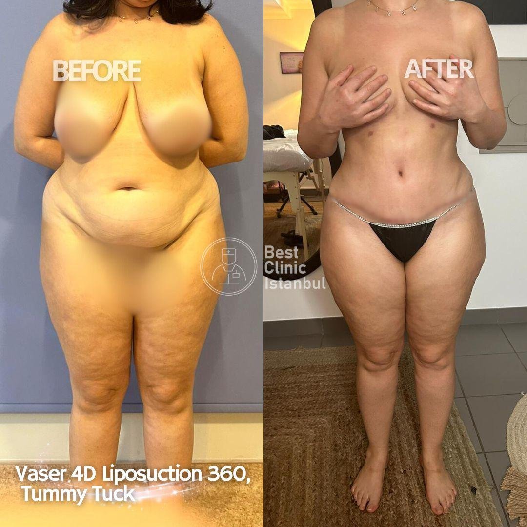 WhatsApp-Image-2025-01-16-at-22.54.40_6ea41062