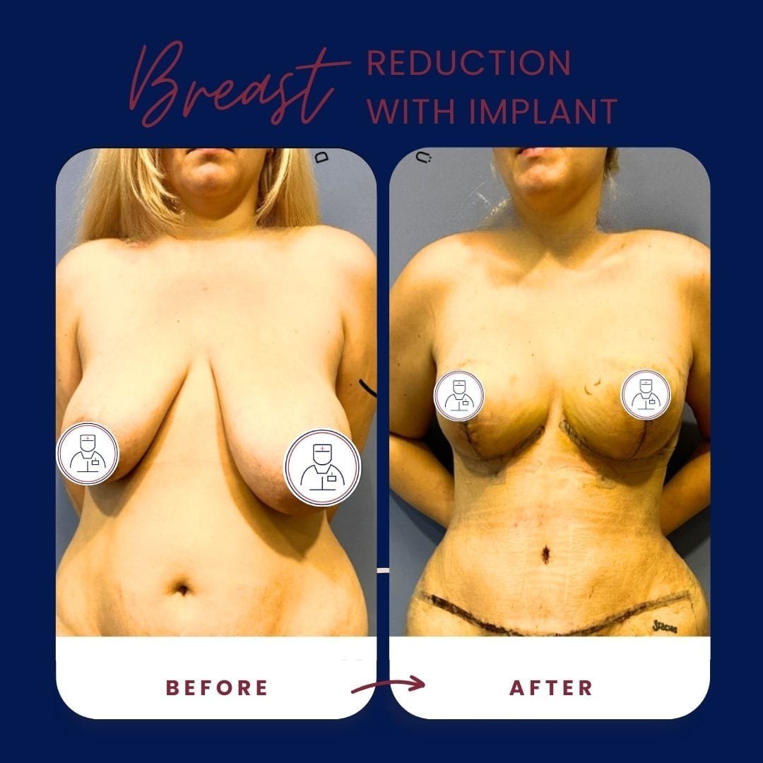 WhatsApp-Image-2025-01-17-at-13.57.30_bcaf256a