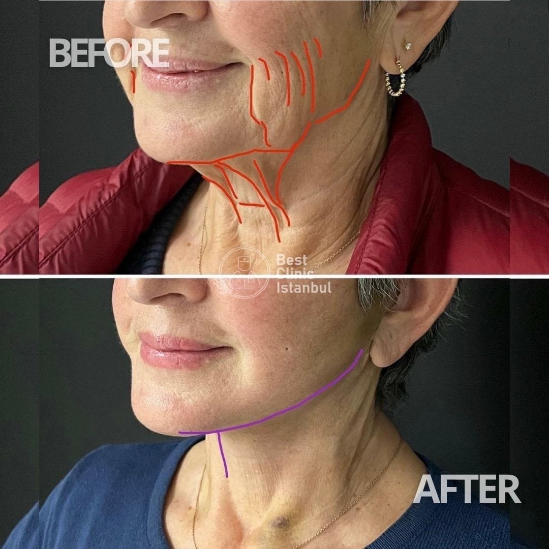 WhatsApp-Image-2025-01-17-at-13.57.38_2ce3cba1