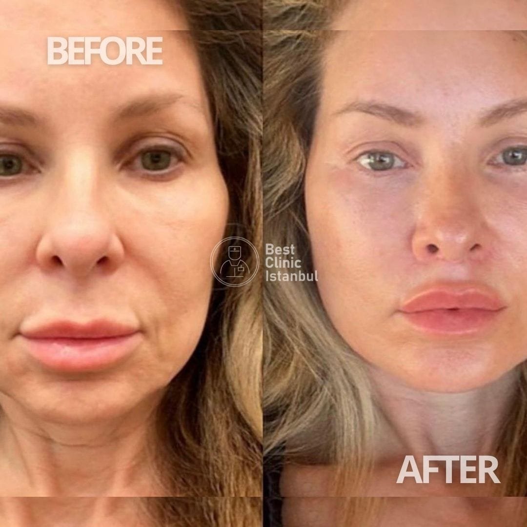 WhatsApp-Image-2025-01-17-at-13.57.39_32fabf71