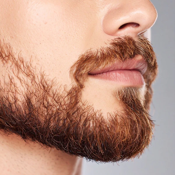 /beard-and-mustache-transplant/