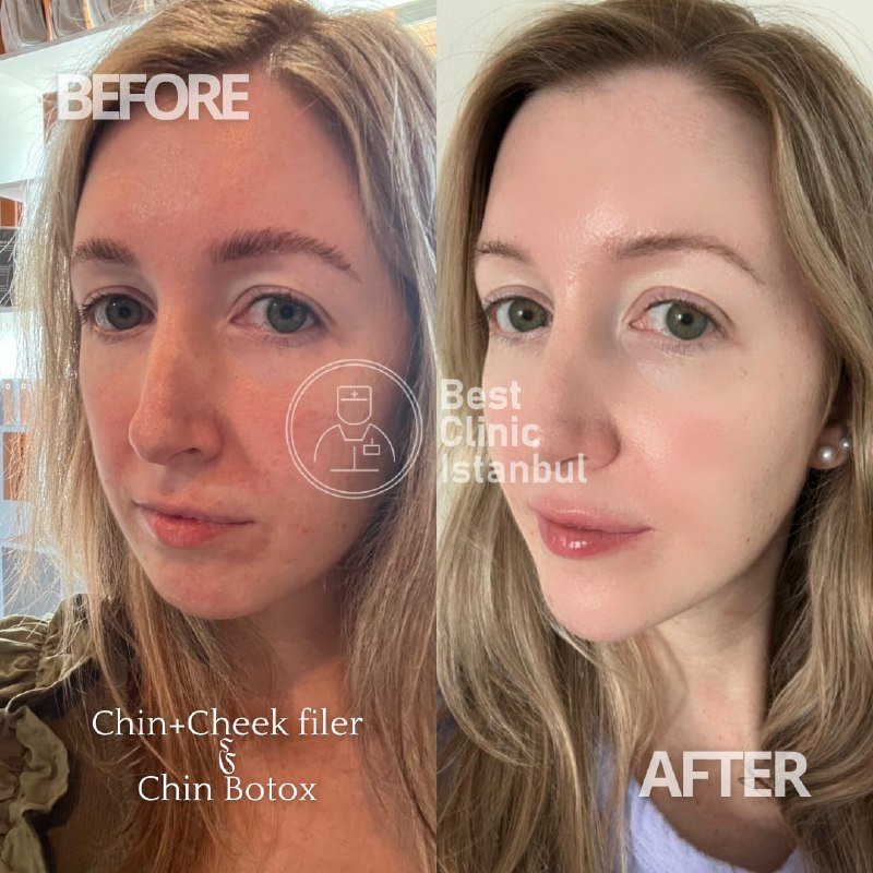 04ebca4f-5af6-4fe7-914d-dc308c21bcdb