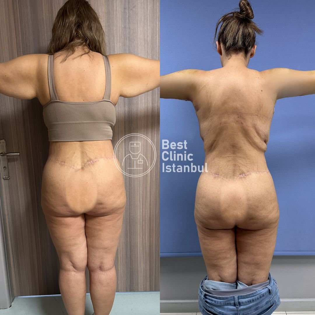 WhatsApp Image 2026-03-26 at 23.18.59