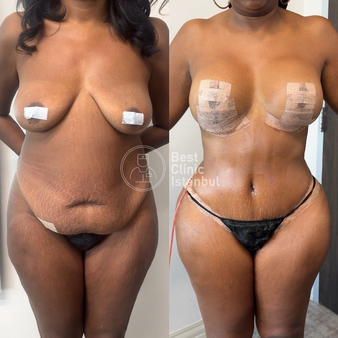 WhatsApp Image 2026-03-26 at 23.20.21