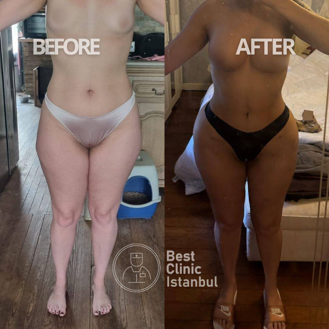 WhatsApp Image 2026-03-26 at 23.21.45