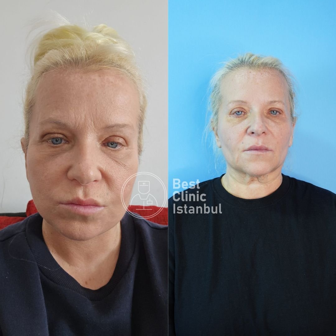 WhatsApp Image 2026-03-27 at 16.33.36