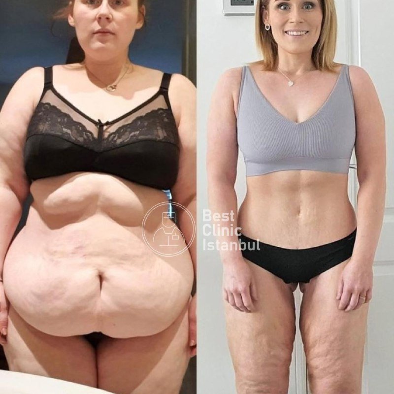 ceb8014c-c96f-4969-b1d8-1887283962aa