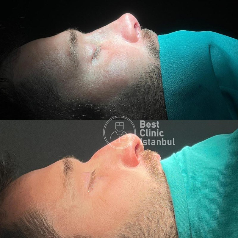 df8e78f0-46f8-4813-9252-25dd282e5381