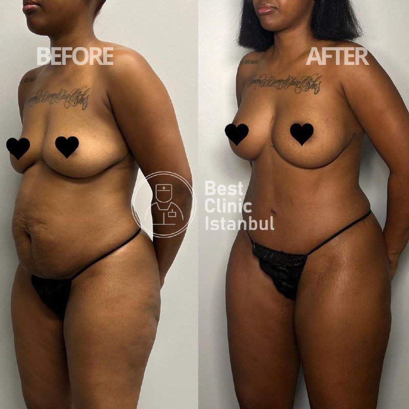 e4e28b2e-28af-46de-a804-ea0925a9bb9d