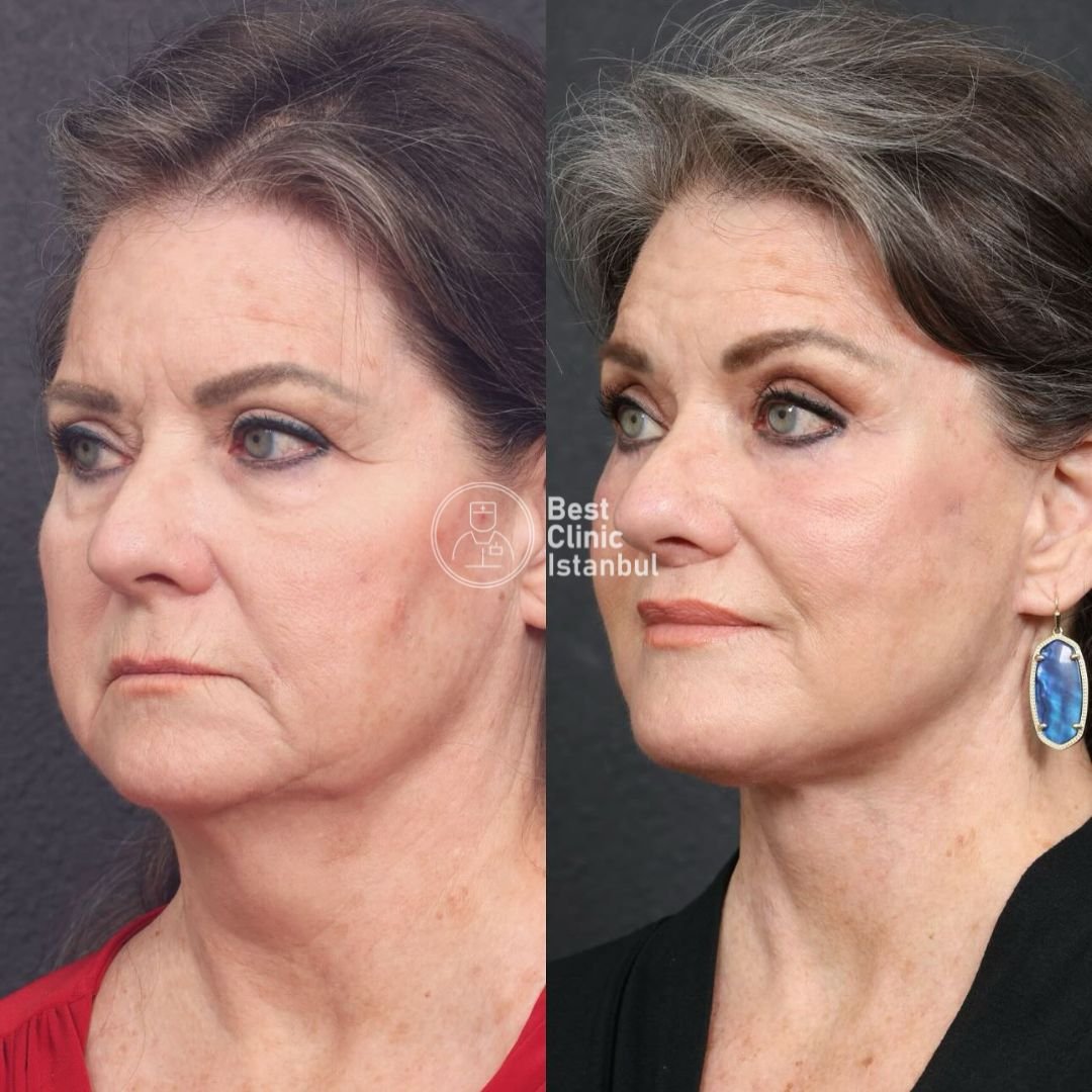 4176c347-a73f-47af-8a41-c63946619452