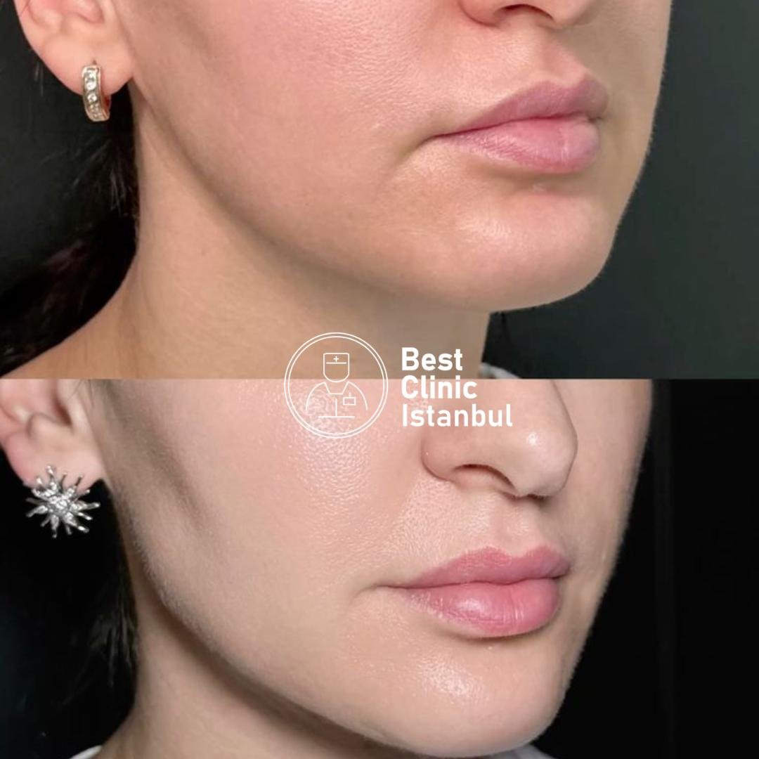 bbf63099-223f-44ae-8331-44c208fd49f9